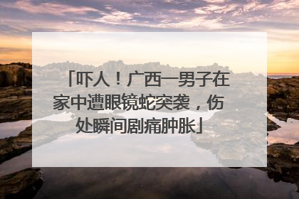 吓人！广西一男子在家中遭眼镜蛇突袭，伤处瞬间剧痛肿胀